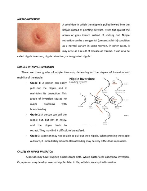 Breast With Puffy Nipple From Rest To Erect .